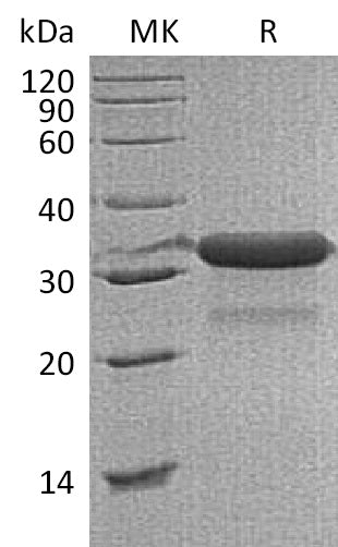 Recombinant Mouse IGFBP-7 (C-6His)