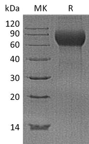 Recombinant Human Hemopexin (C-6His)