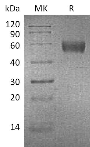 Recombinant Mouse ApoH (C-6His)