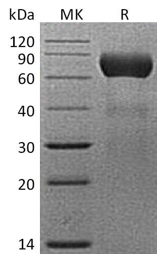 Recombinant Mouse CD39L1 (C-6His)