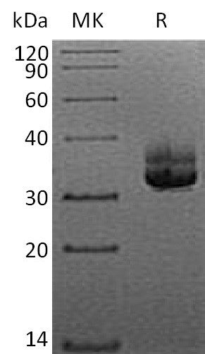 Recombinant Human CD207 (N-6His)