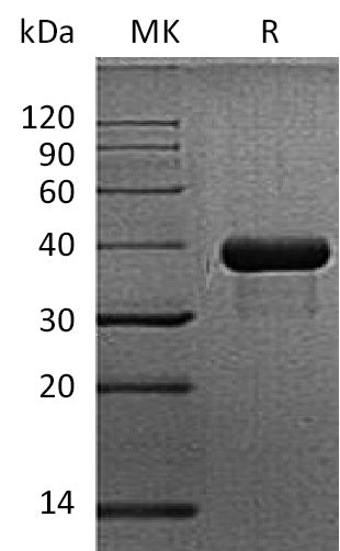 Recombinant Mouse SPARC (C-6His)
