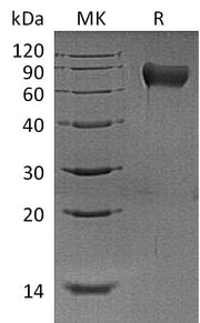 Recombinant Mouse Hemopexin (C-6His)