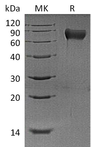 Recombinant Mouse Hemopexin (C-6His)
