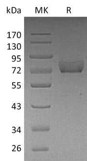 Recombinant Human Thrombomodulin (C-6His)