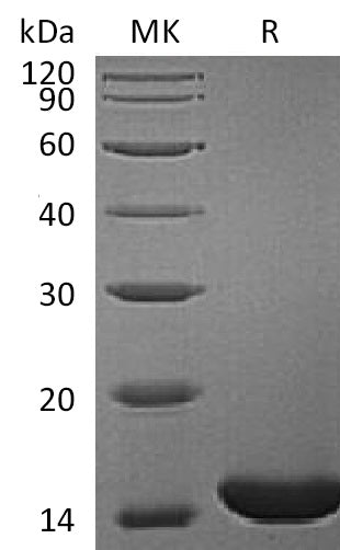 Recombinant Human RBP1