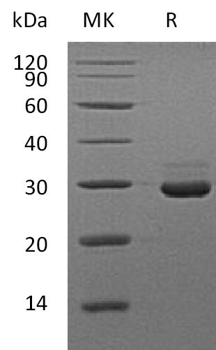 Recombinant Mouse VSIG8 (C-6His)