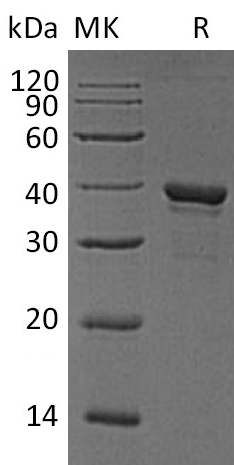 Recombinant Human ARG1 (C-6His)