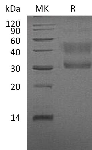 Recombinant Human HGF R (Truncated, C-6His)