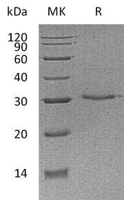 Recombinant Human VSIG8 (C-6His)
