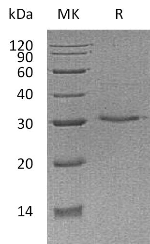 Recombinant Human VSIG8 (C-6His)
