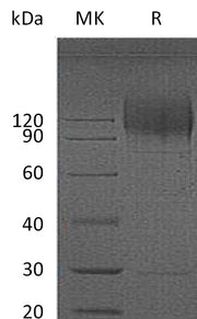Recombinant HIV gp120 (C-8His)