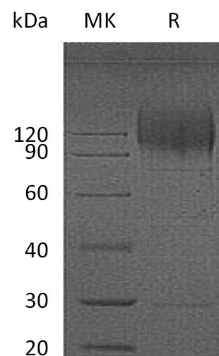 Recombinant HIV gp120 (C-8His)
