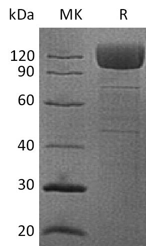 Recombinant Human CD36 (C-Fc)