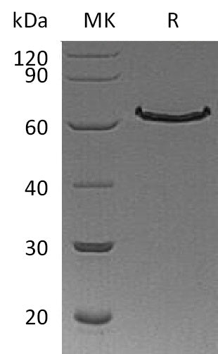 Recombinant Human DLL1 (C-6His)