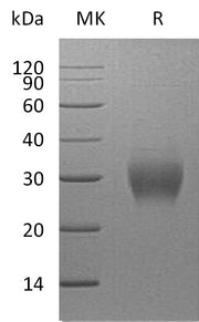 Recombinant Human Asprosin (N-8His)