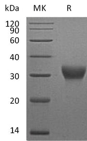 Recombinant Mouse VSIG4 (C-6His)