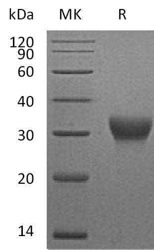 Recombinant Mouse VSIG4 (C-6His)
