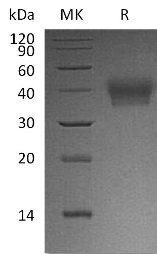 Recombinant Human BTN2A1 (C-6His)