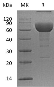 Recombinant Human SLAMF6 (C-Fc)