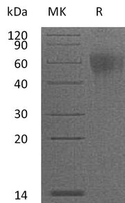 Recombinant Mouse IL-2RG (C-6His)