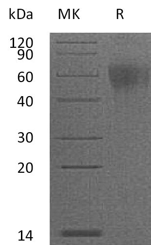Recombinant Mouse IL-2RG (C-6His)