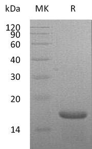 Recombinant Mouse IL-21 (N-6His)