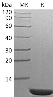 Recombinant S. cerevisiae TIM14