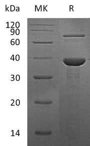 Recombinant Human RBP3 (N-6His)
