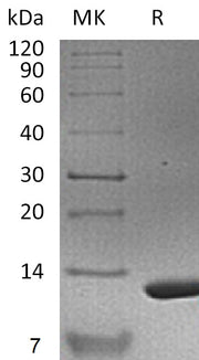 Recombinant Mouse S100A11 (N-6His)