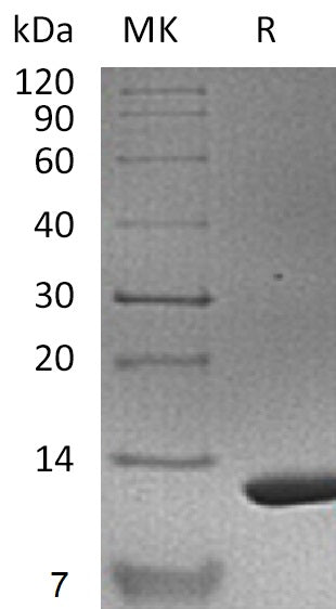 Recombinant Mouse S100A11 (N-6His)