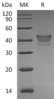 Recombinant Human MetAP1