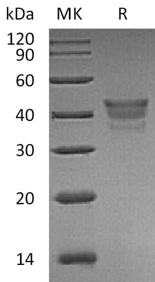 Recombinant Human MetAP1