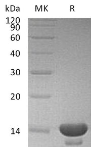 Recombinant Human CST3