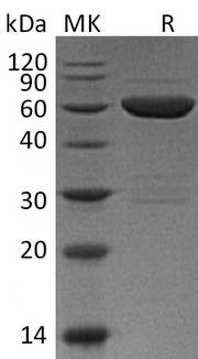 Recombinant Mouse Galectin-9 (N-GST)