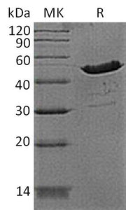 Recombinant Human CKB (N-6His)