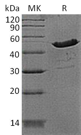 Recombinant Human CKB (N-6His)