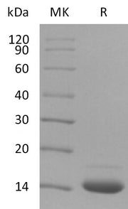 Biotinylated Human Fibronectin (ED-B domain, N-Avi-6His)