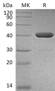 Recombinant Human IDO2 (C-6His)