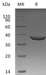 Recombinant Human Sting (N-Sumo-6His)