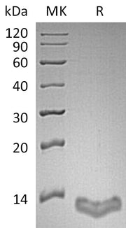 Recombinant Human S100A16