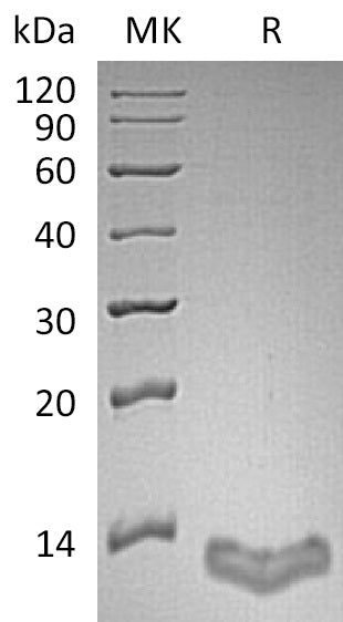 Recombinant Human S100A16