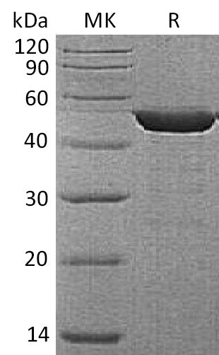 Recombinant Human ENO1 (C-6His)