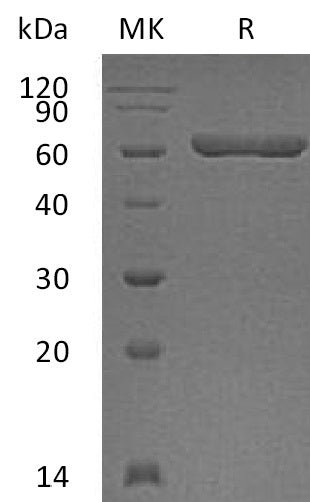 Recombinant Human Galectin-9 (N-GST)
