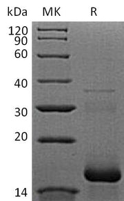 Recombinant Human APOB (N-6His)