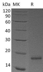 Recombinant Human Claudin-18.2 (N-8His)