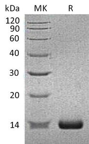 Recombinant Human SAA2 (N-6His)