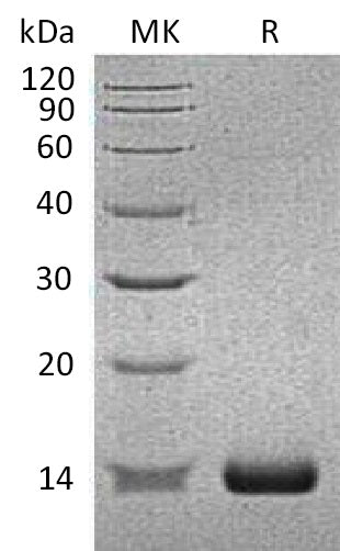 Recombinant Human SAA2 (N-6His)