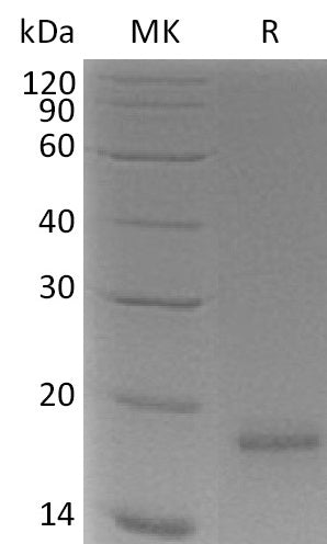 Recombinant Human CLDN18.1 (N-8His)