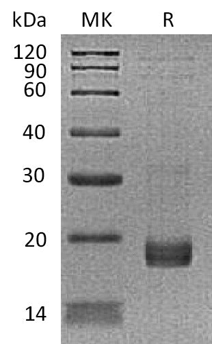 Recombinant Human TNNC1 (N-6His)